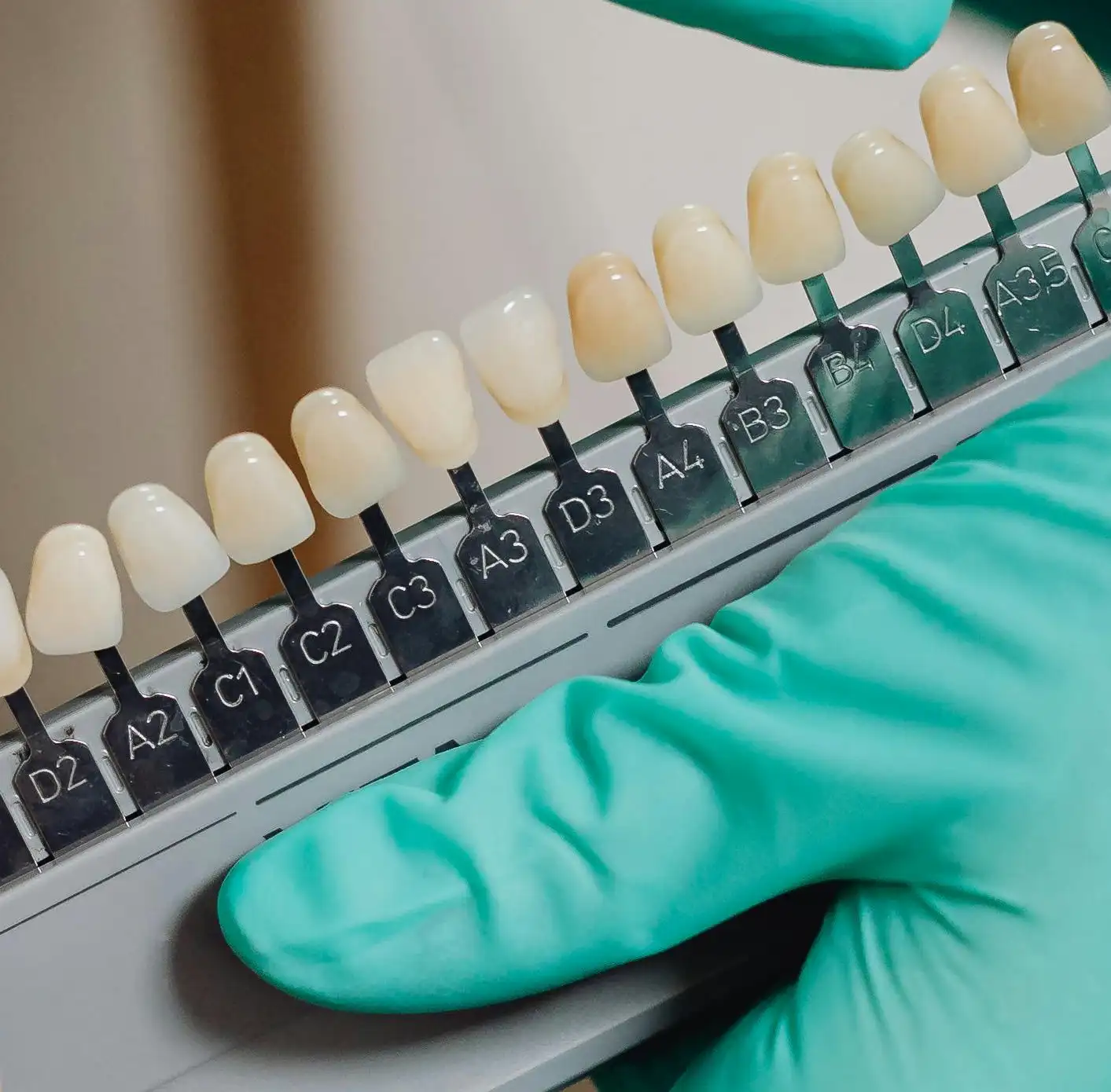 Gloved hand holding a dental shade guide with tooth color samples labeled for matching.