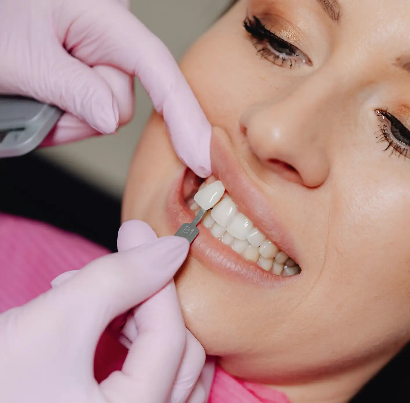 Close-up of a dental professional wearing pink gloves matching a tooth shade guide to a patient's upper teeth during a cosmetic dentistry procedure.