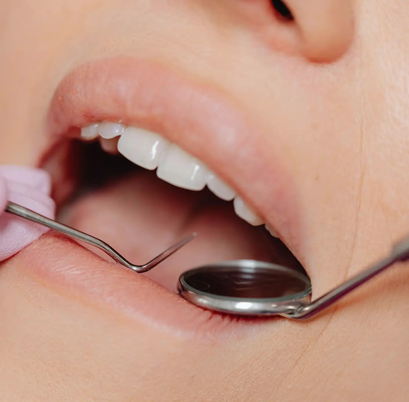 Close-up of a person's mouth with dental tools examining clean, white teeth.