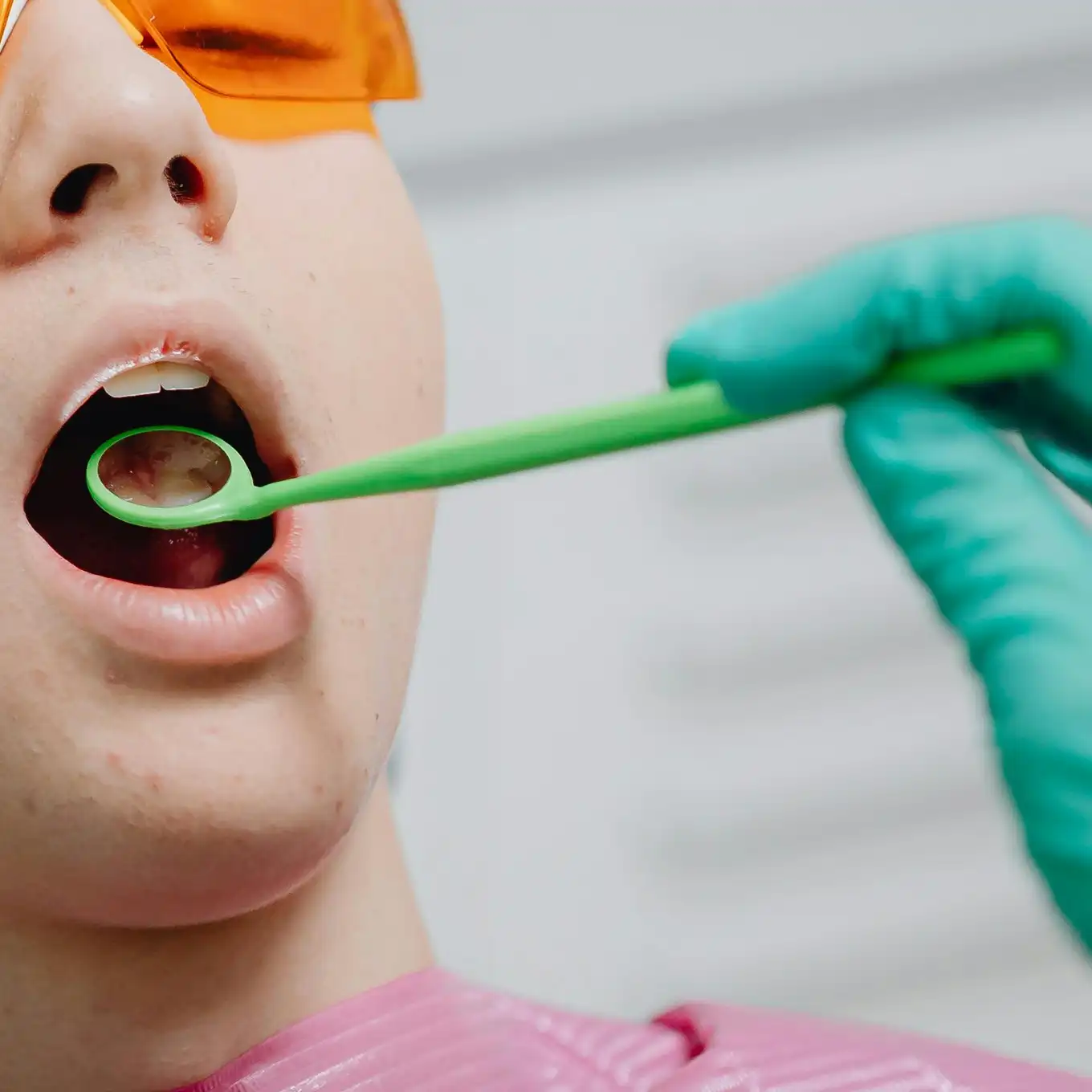 Dentist wearing green gloves holding a dental mirror inside a patient's open mouth reviewing dental veneers.