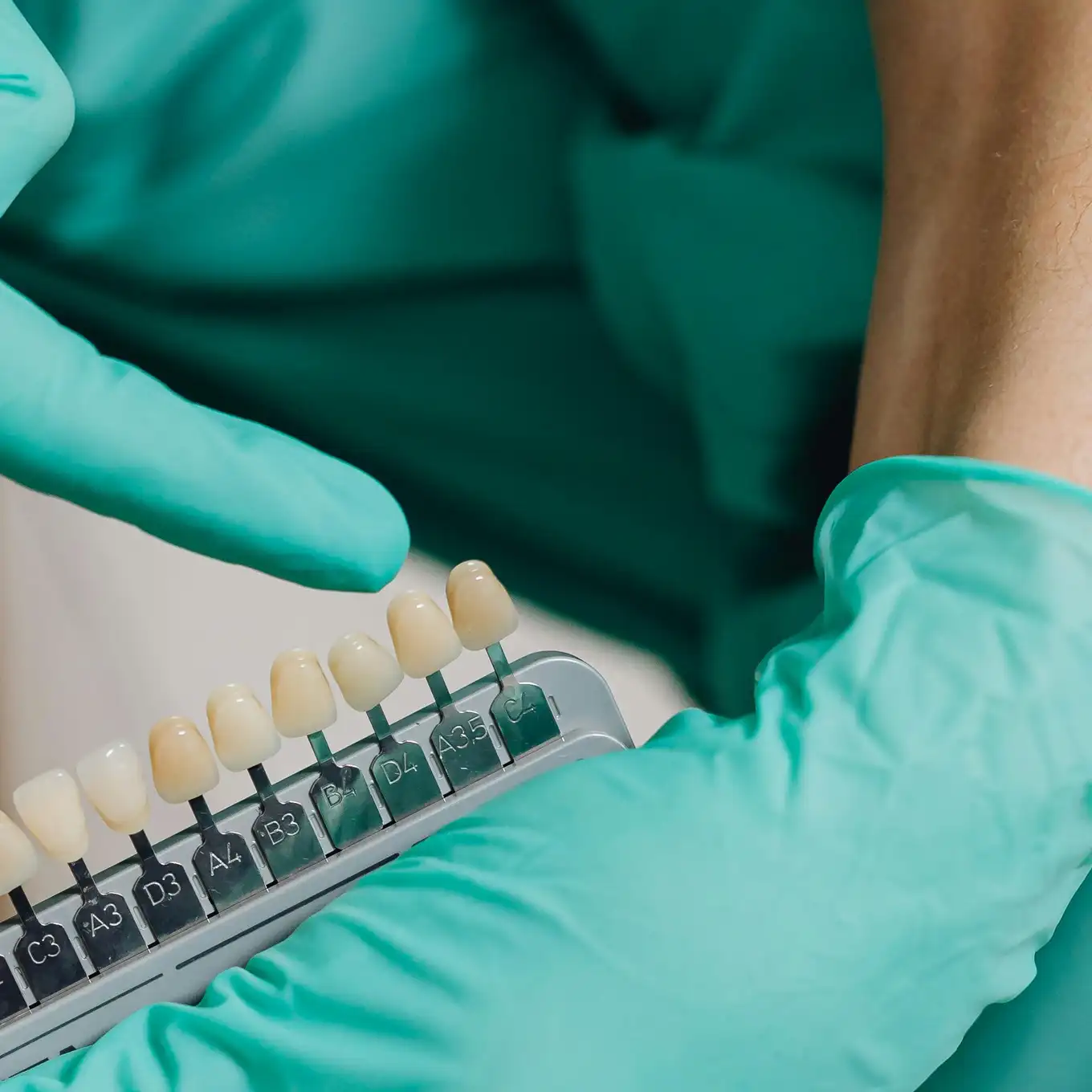 Dental professional wearing teal gloves holding a dental shade guide showing different tooth colours when matching a dental crown.