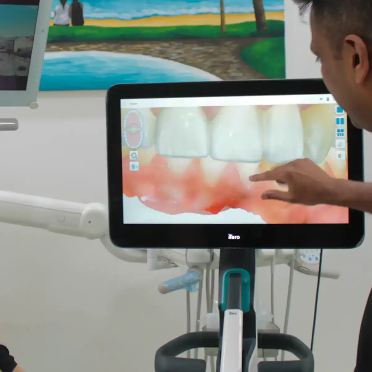 Person pointing at a digital 3D image of teeth and gums on a dental monitor in a clinic.