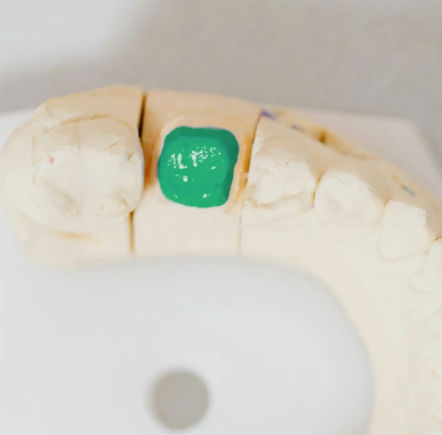 Dental mold with a green-colored prepared cavity on one tooth.