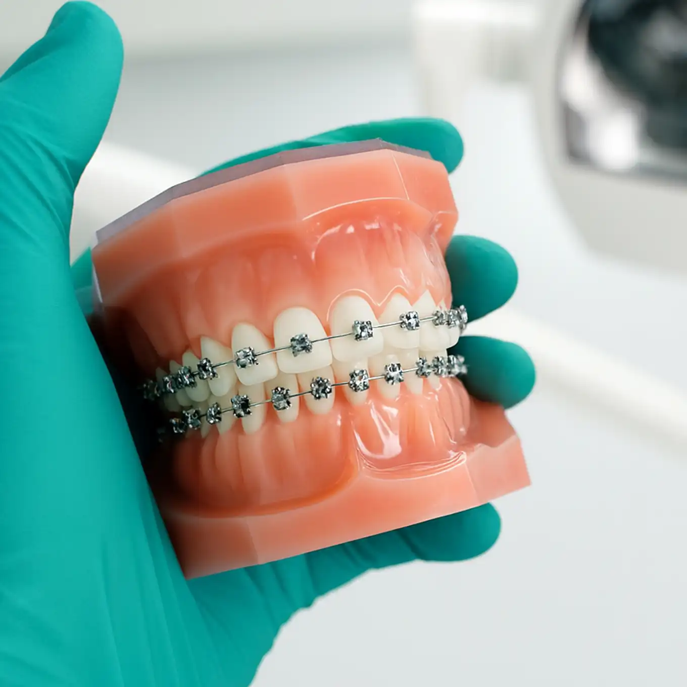 Hand wearing teal glove holding a dental model with metal braces on upper and lower teeth.
