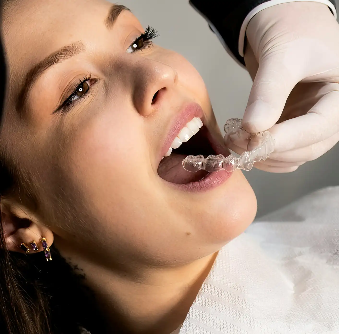 Orthodontist wearing gloves placing a clear dental aligner into a smiling woman's open mouth.