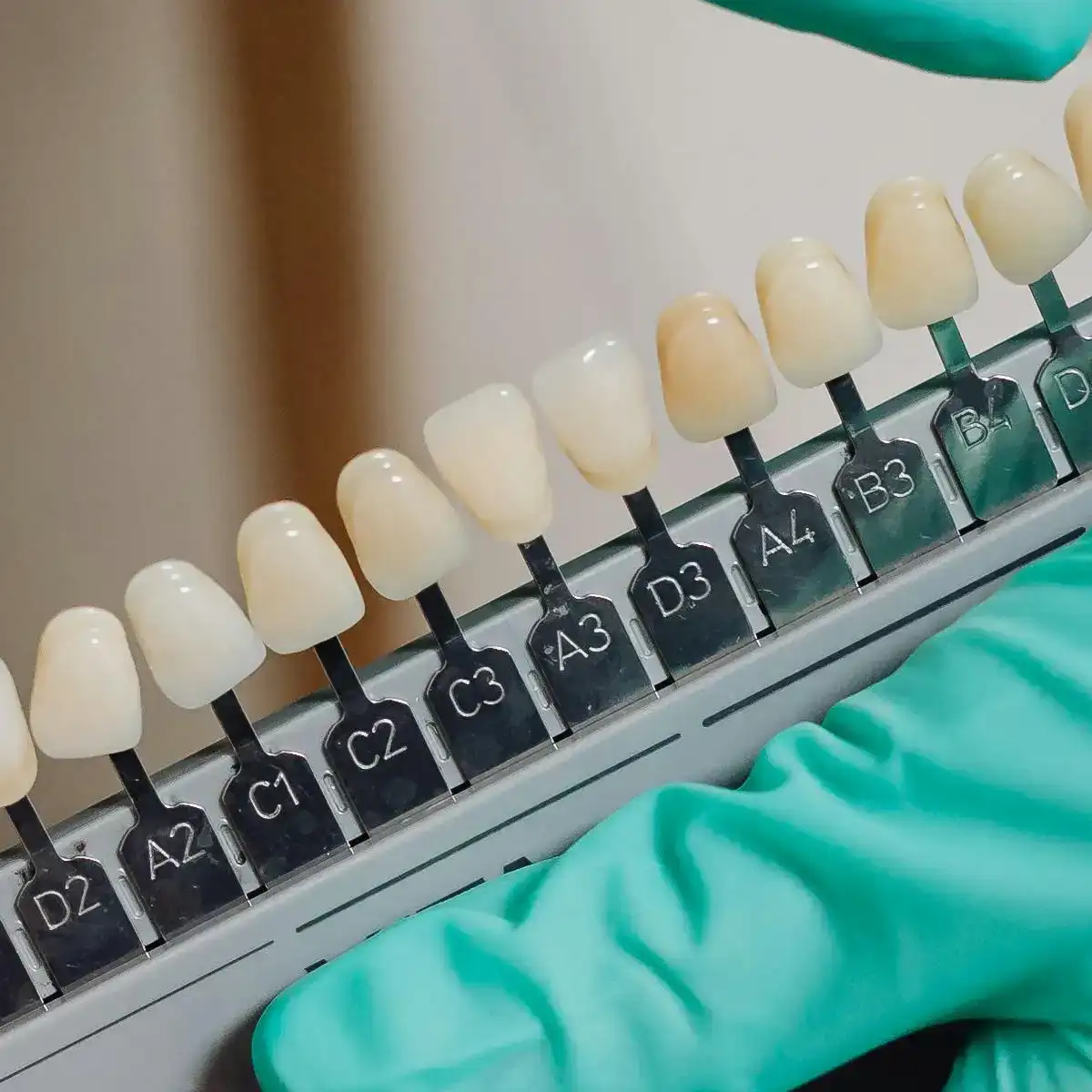Close-up of a dental shade guide held by a gloved hand, showing various tooth color samples labeled from D2 to B2.