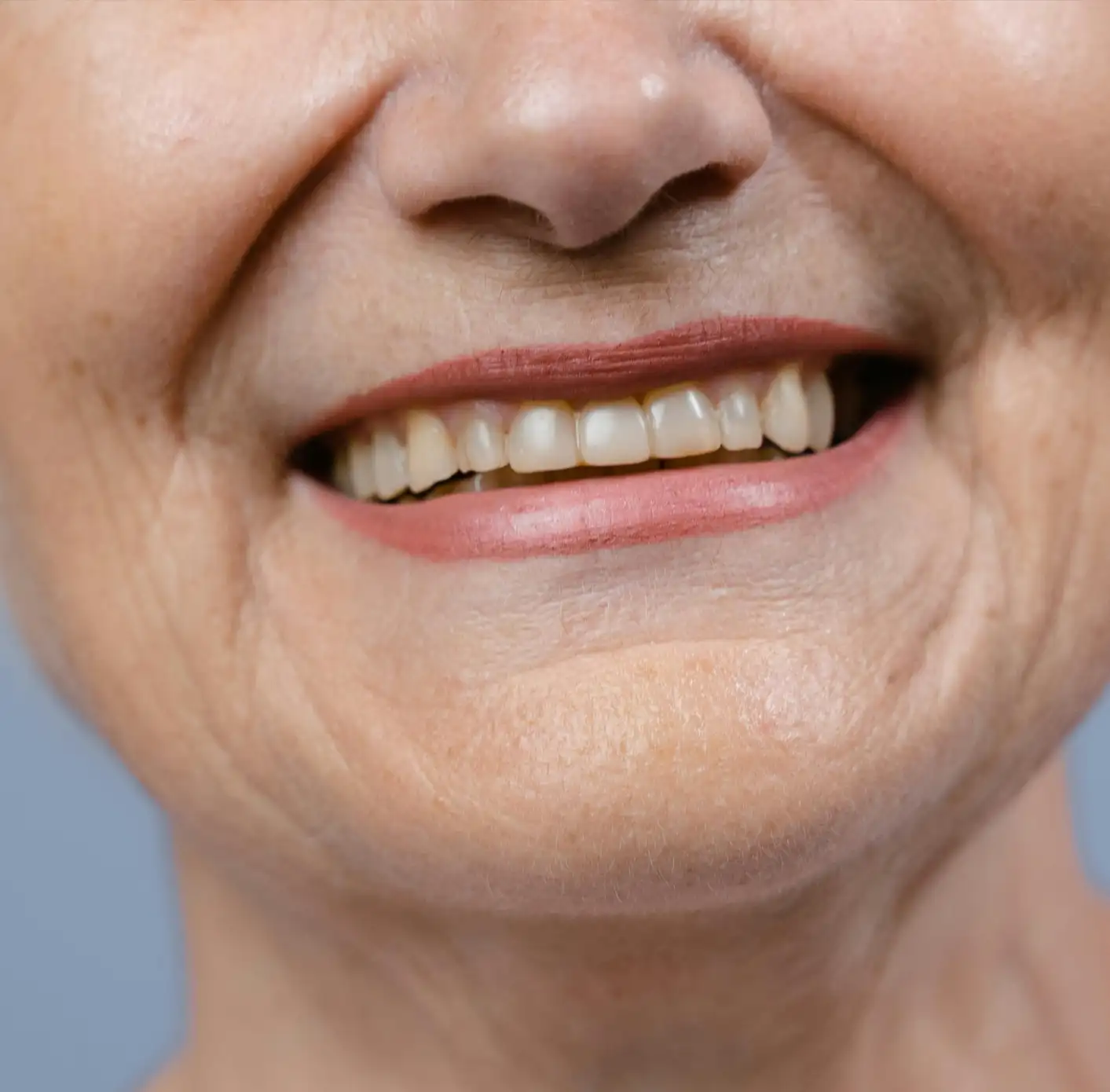 Close-up of an older woman's smile showing natural looking teeth after dental implants.