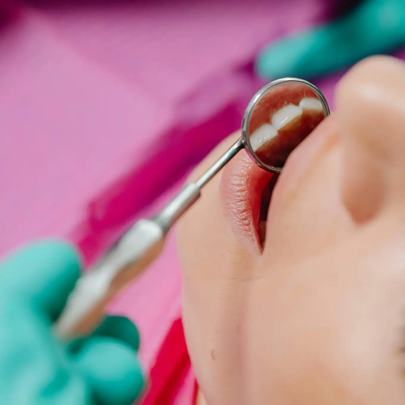 Close-up of a dental mirror reflecting a patient's upper teeth during an oral examination.