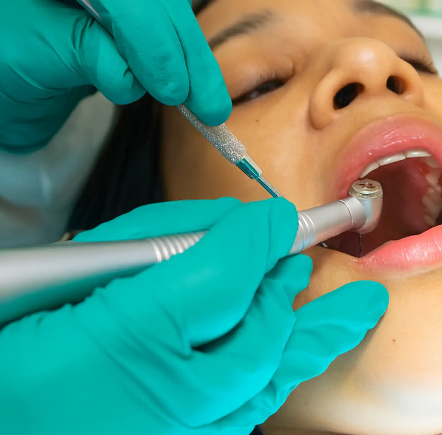 Dentist wearing green gloves using dental tools to examine a patient's open mouth.