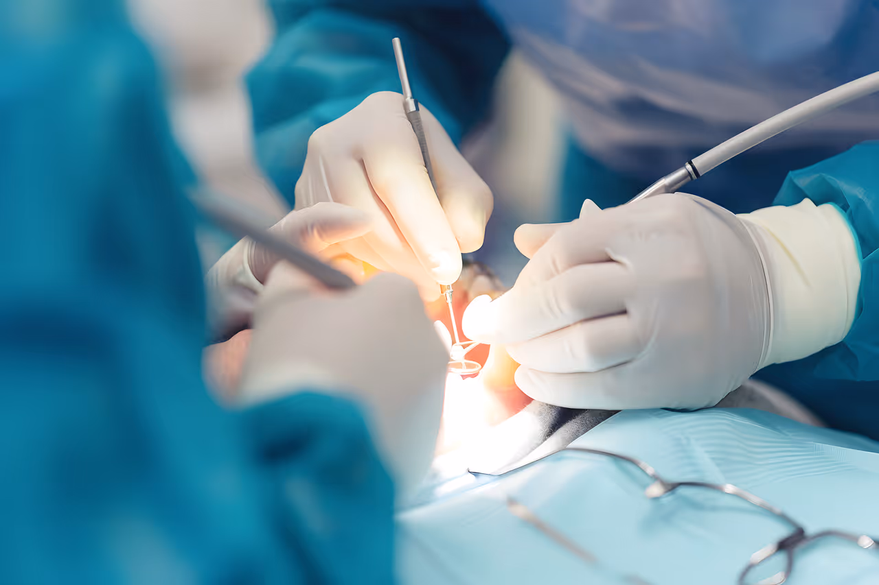 Oral Surgery in La Verne, CA