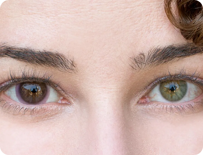 transitions contacts