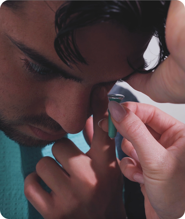 Scleral contact lens fitting