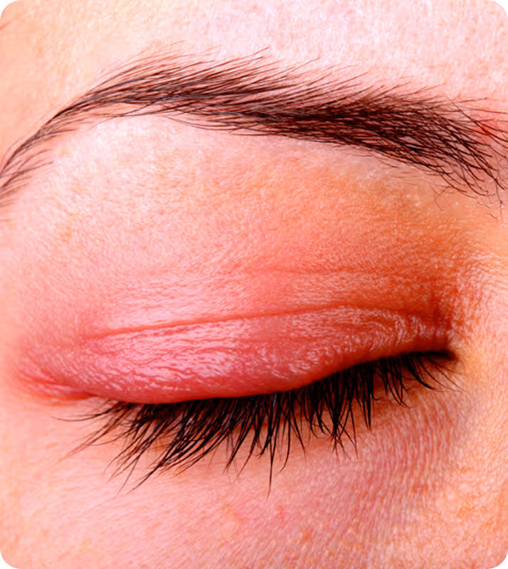 eye man retina bright