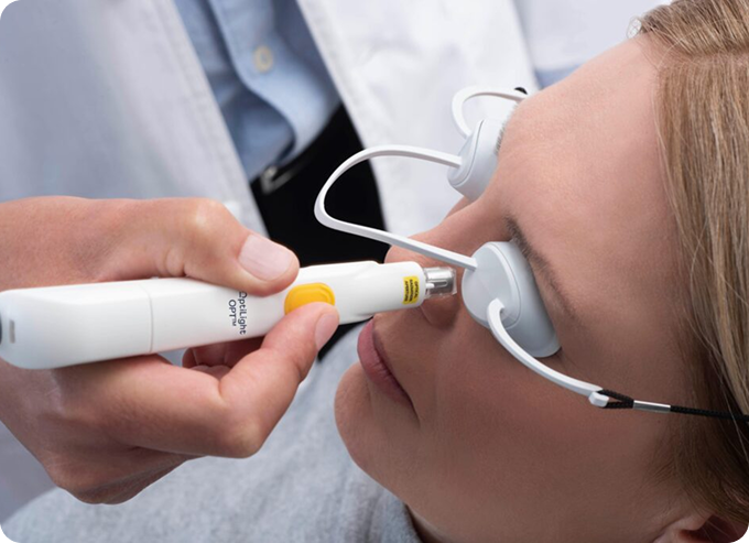 IPL para ojos secos