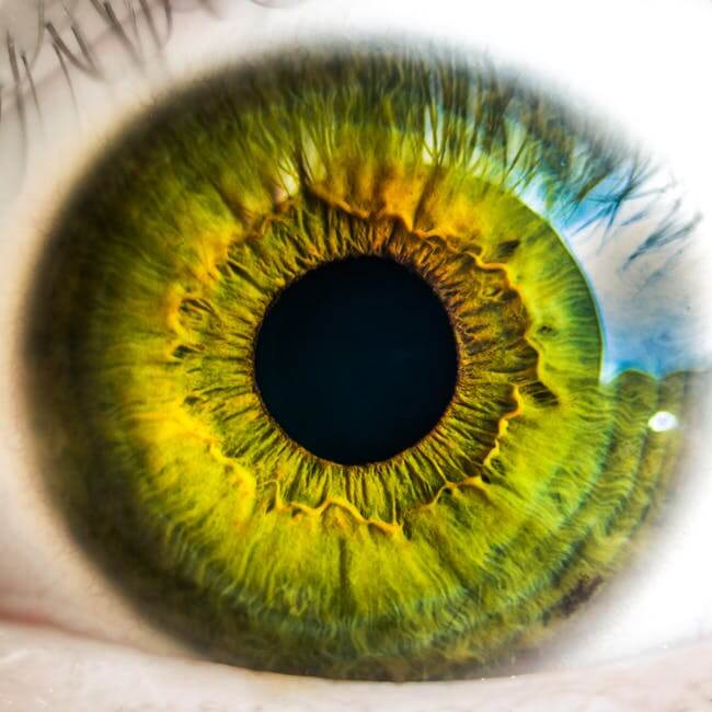 Specialty prosthetic lenses for cornea conditions explained