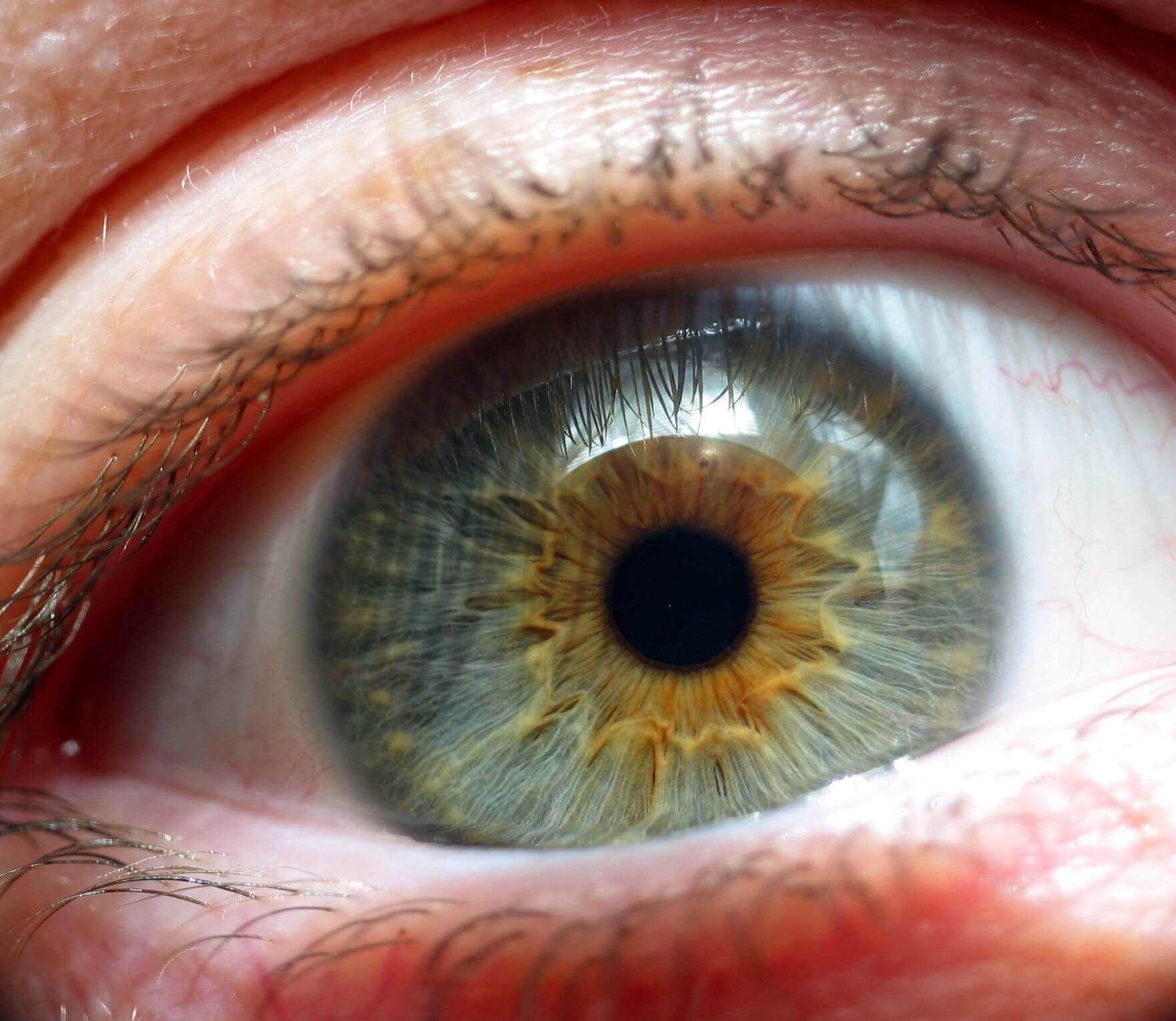 Five Questions to Ask Your Optometrist about Orthokeratology