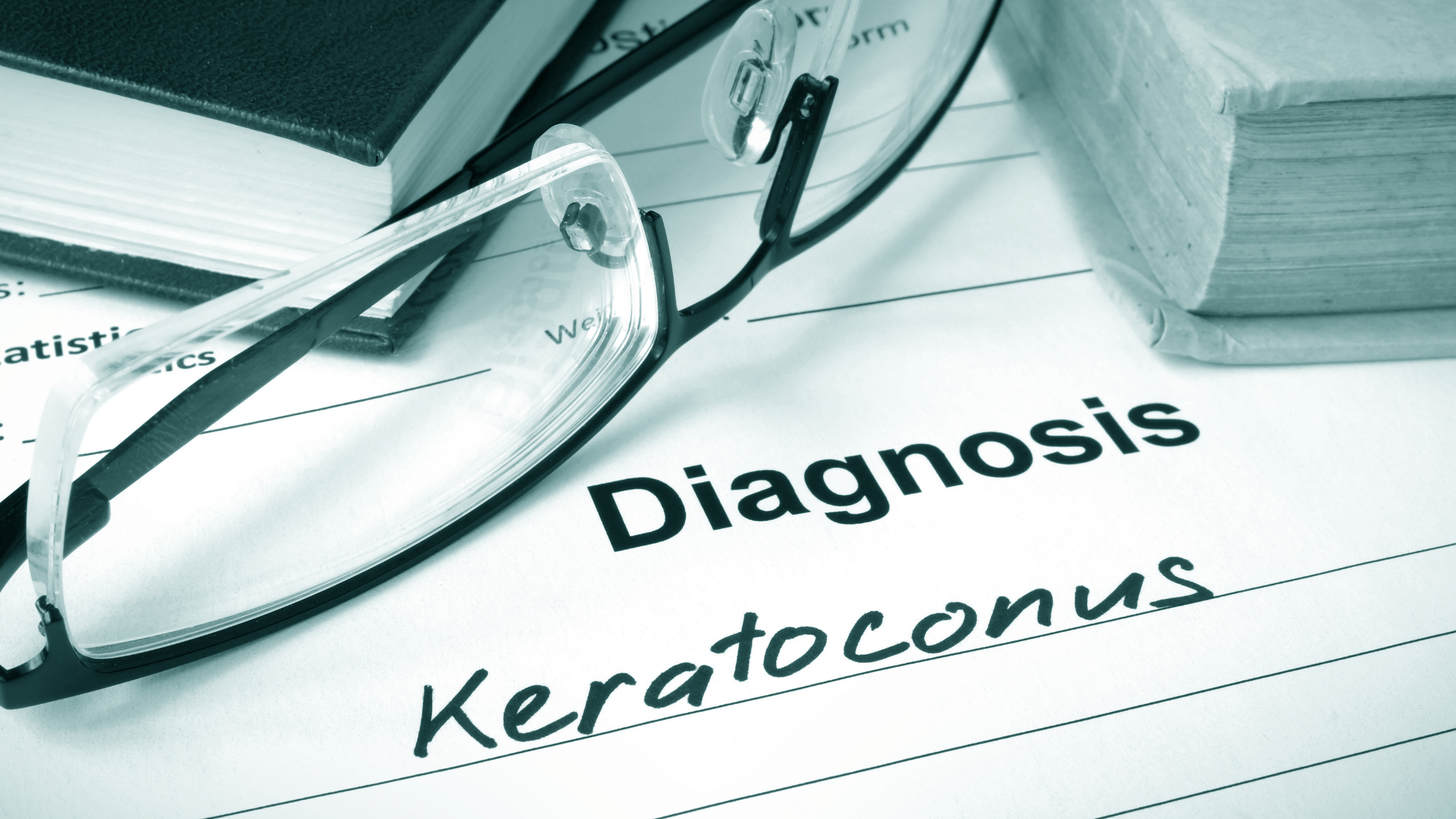 5 Things To Expect If You've Been Diagnosed with Keratoconus