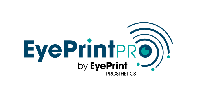EyePrintPRO™: Precision and Customization in Treating Irregular Corneas