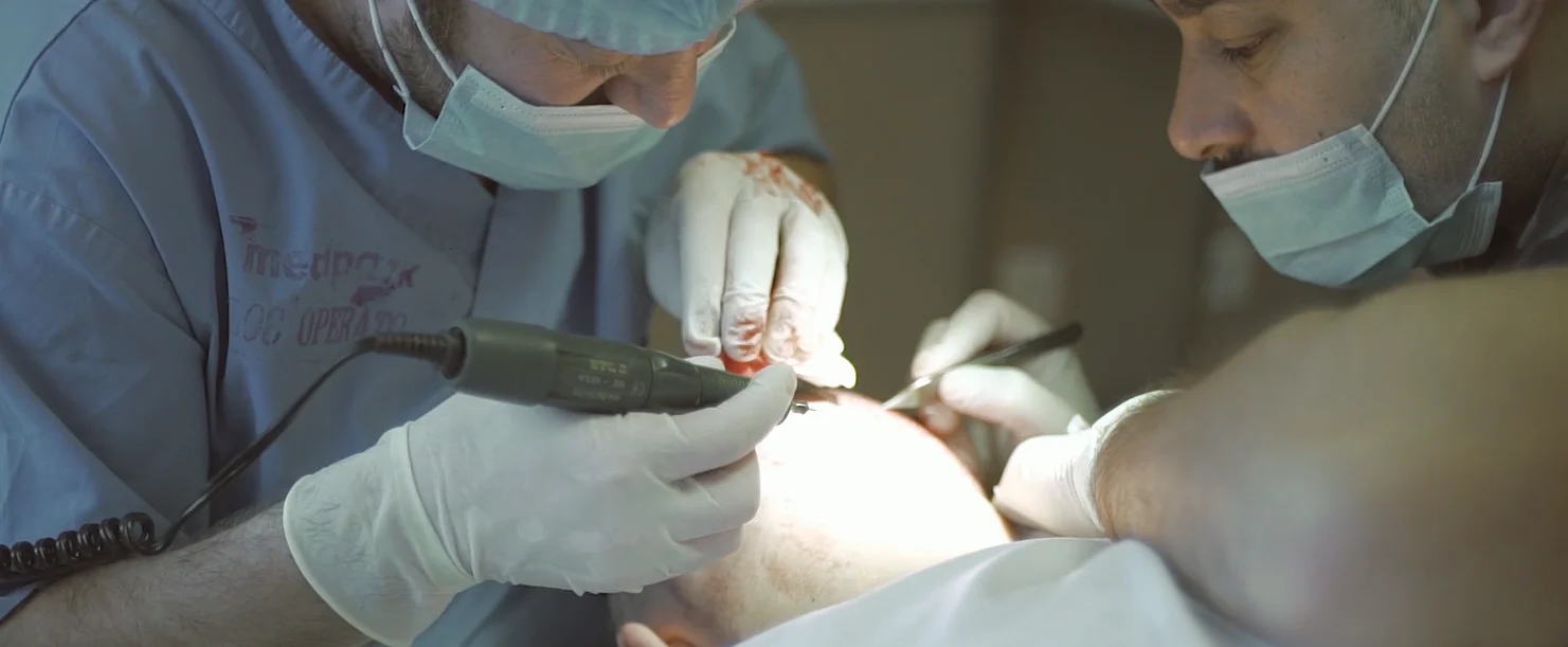 Hair transplant treatment at a partner clinic in Chișinău – photo 2