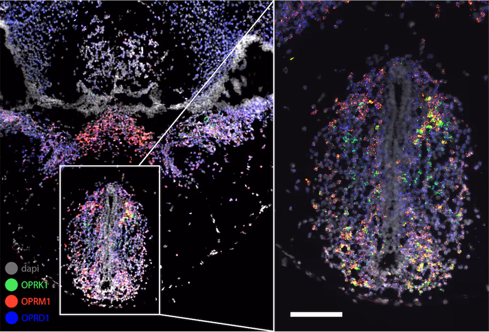 Multiplex RNAscope fluorescent in situ hybridization image of frog brain tissue.
