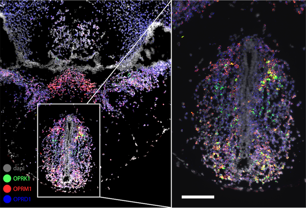 Multiplex RNAscope fluorescent in situ hybridization image of frog brain tissue.