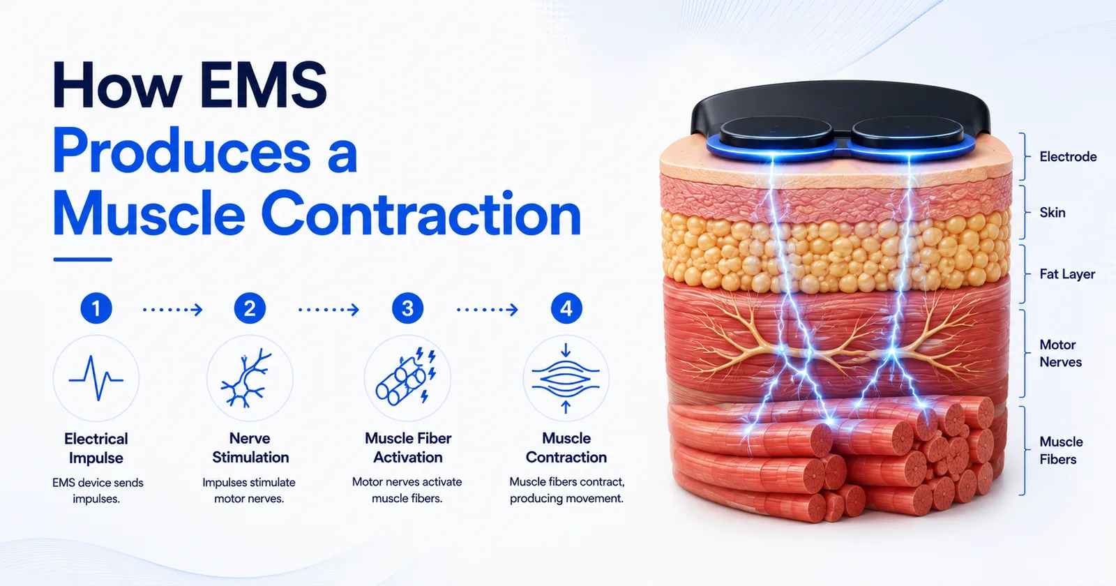 How an EMS pulse becomes a muscle contraction