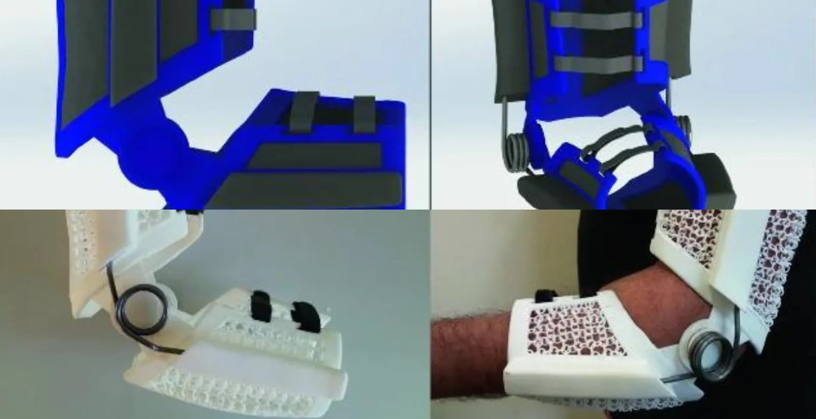 Four-panel image showing the digital renderings and physical 3D-printed prototypes of an AI-generated orthotic arm brace. The top row displays CAD designs; the bottom row shows printed devices, including one worn on a human arm.