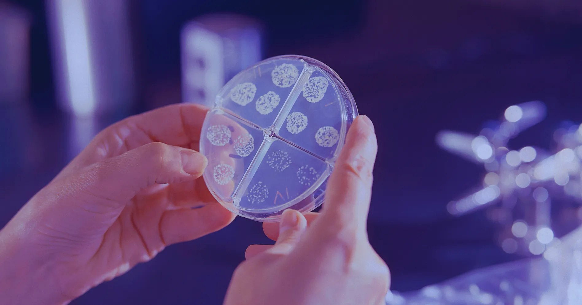 How a biopharma leader achieved 95%+ sales-to-consumption matching with AI