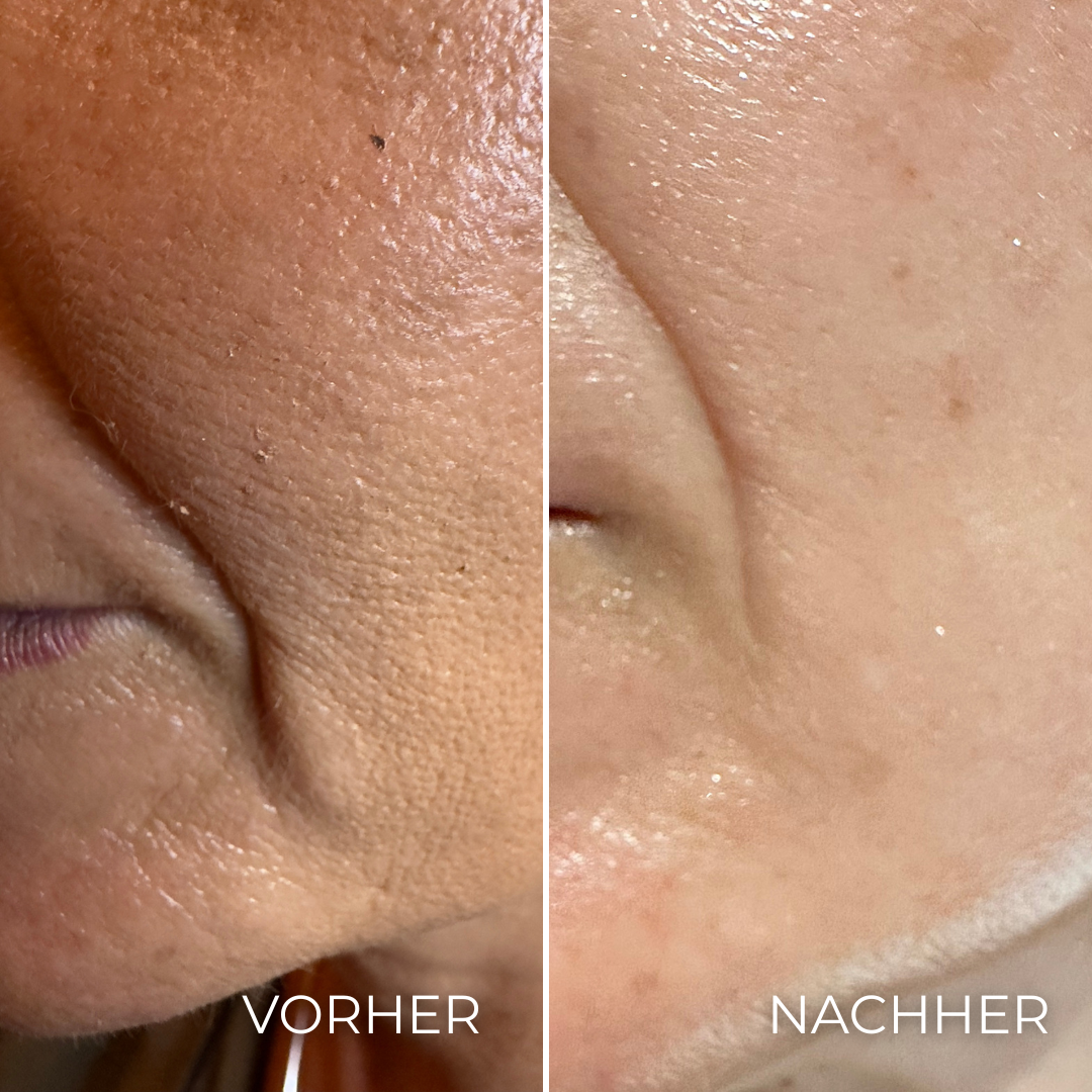 image of a luxurious cosmetic treatment room with advanced facial equipment in a clinic