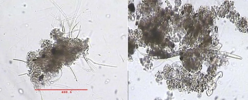 Understanding Biofloc Microorganisms A Sustainable Solution for Aquaculture