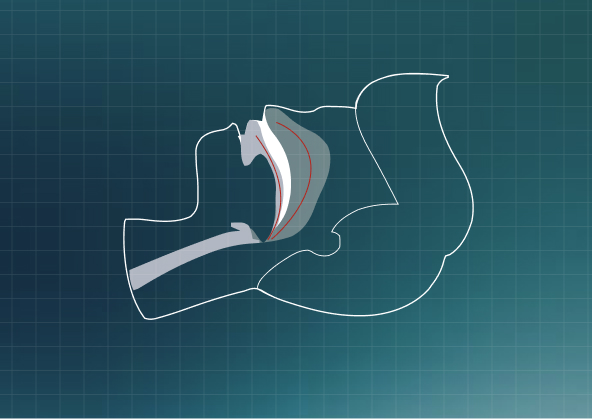 Diagram showing how sleep device works