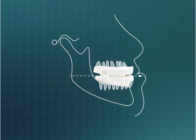 Diagram showing how sleep device works