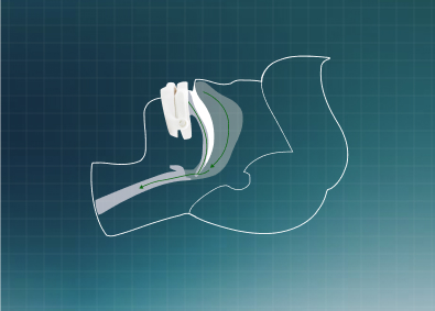 Diagram showing how sleep device works