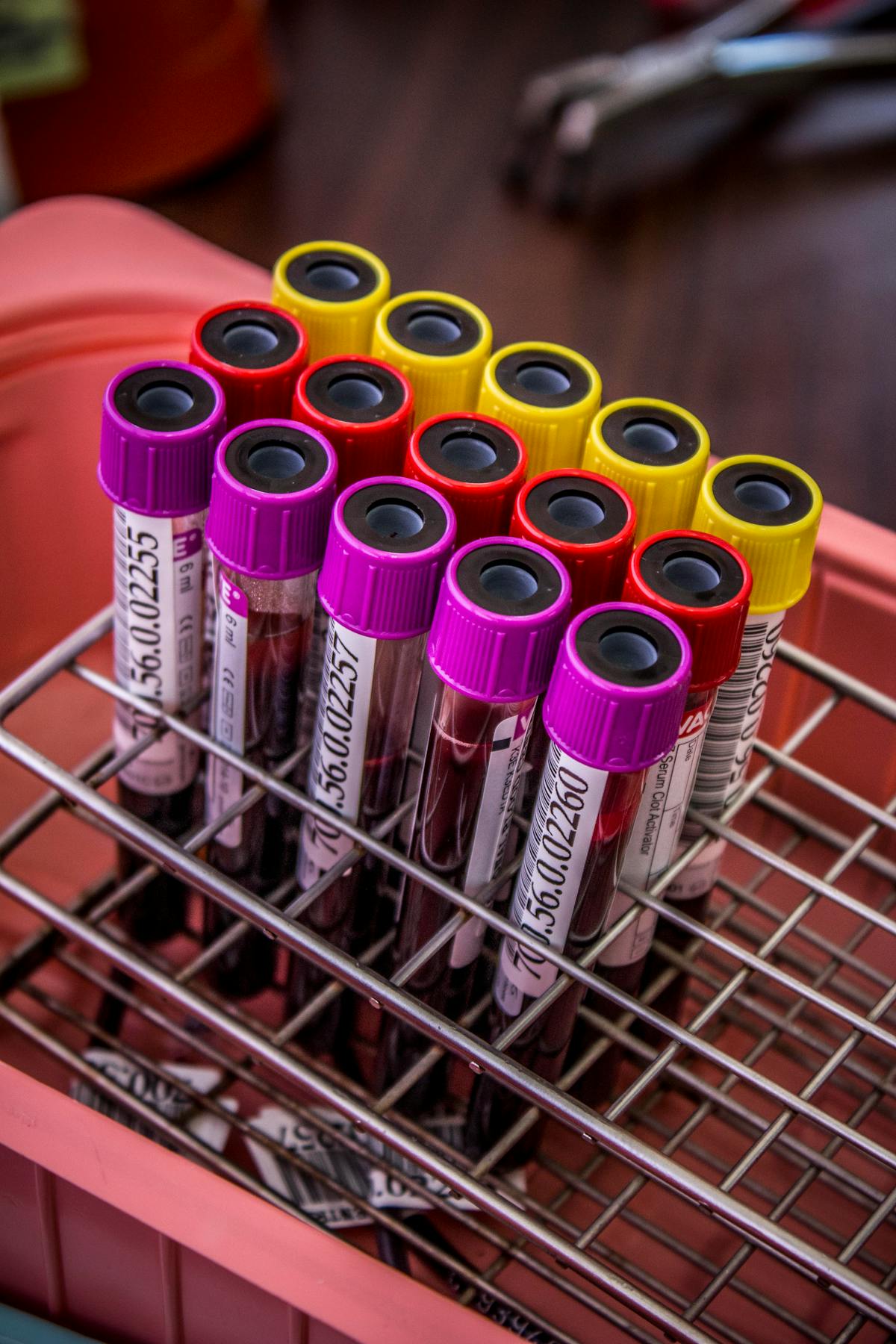 Rack holding blood collection tubes with purple, red, and yellow caps in a medical setting.