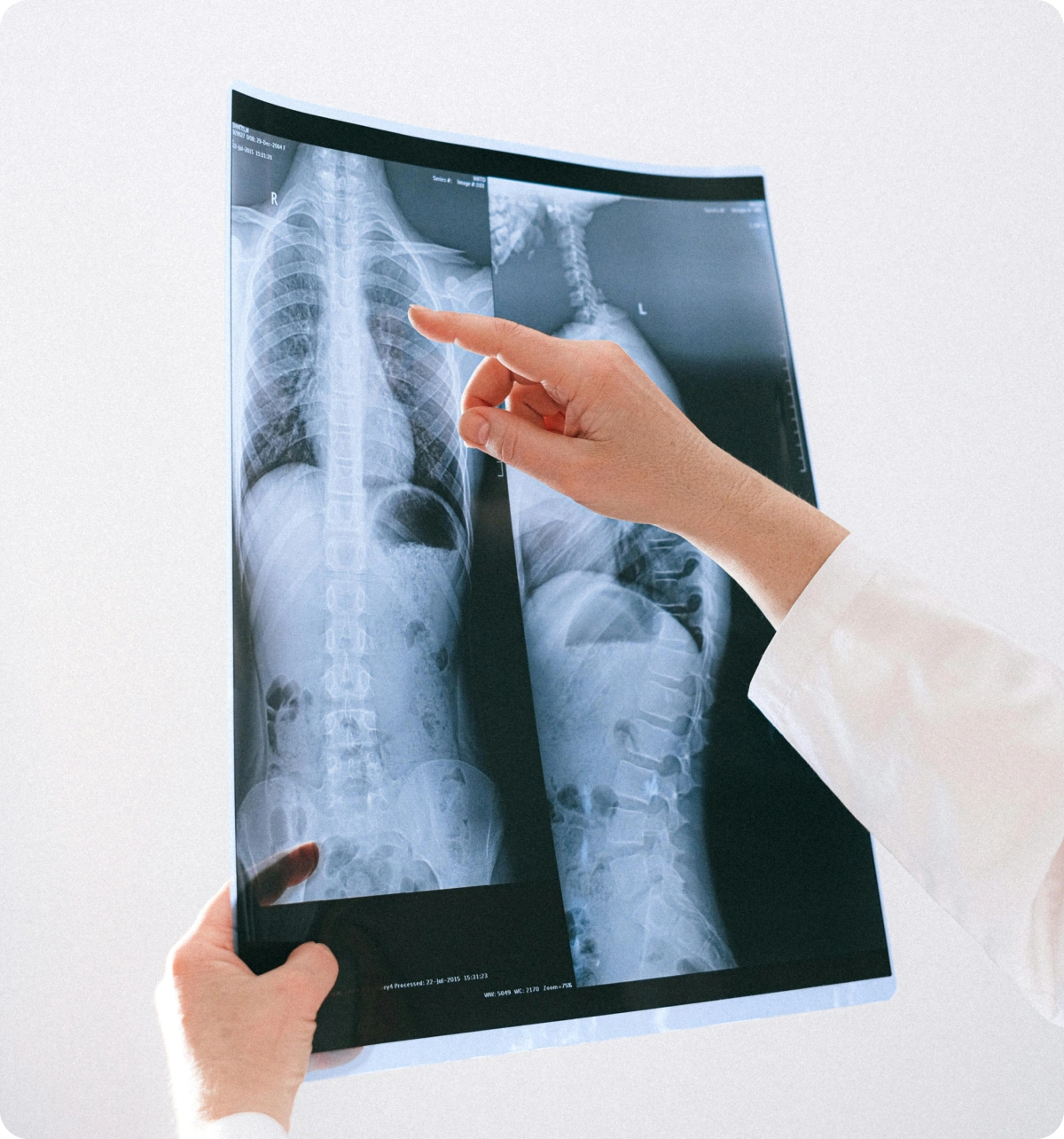 A person pointing at an x - ray image on a wall.