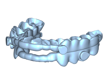EviSmart CAD design orthodontic
