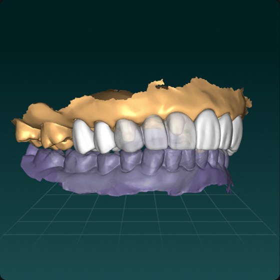 Crown design