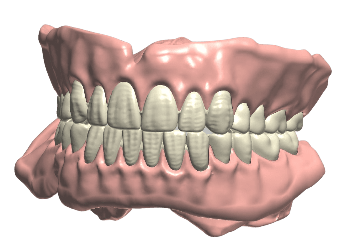 Jimmy Denture Clear .png