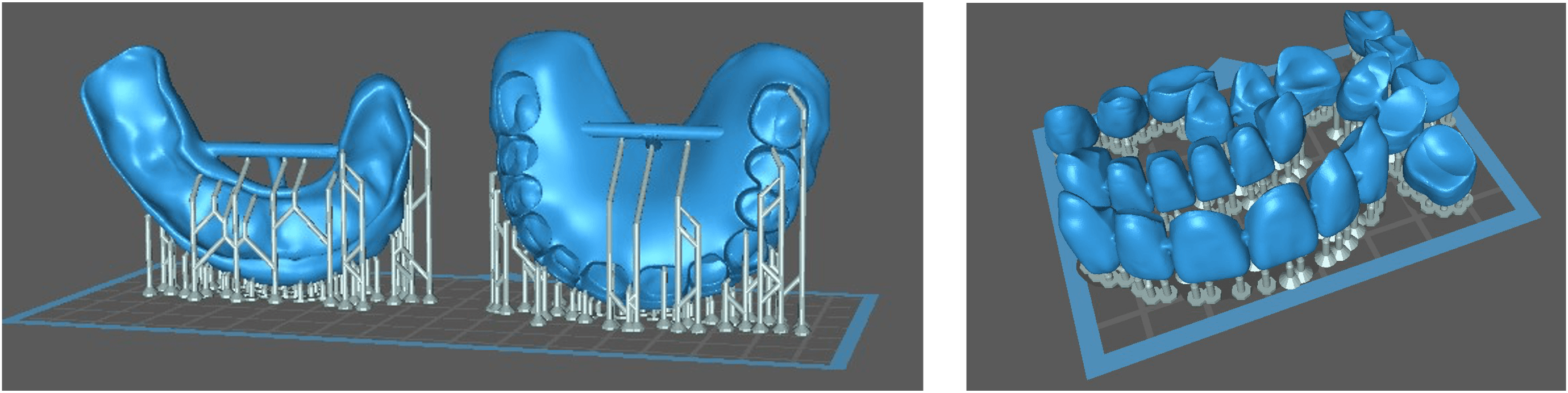 3dprintedfilenested.png
