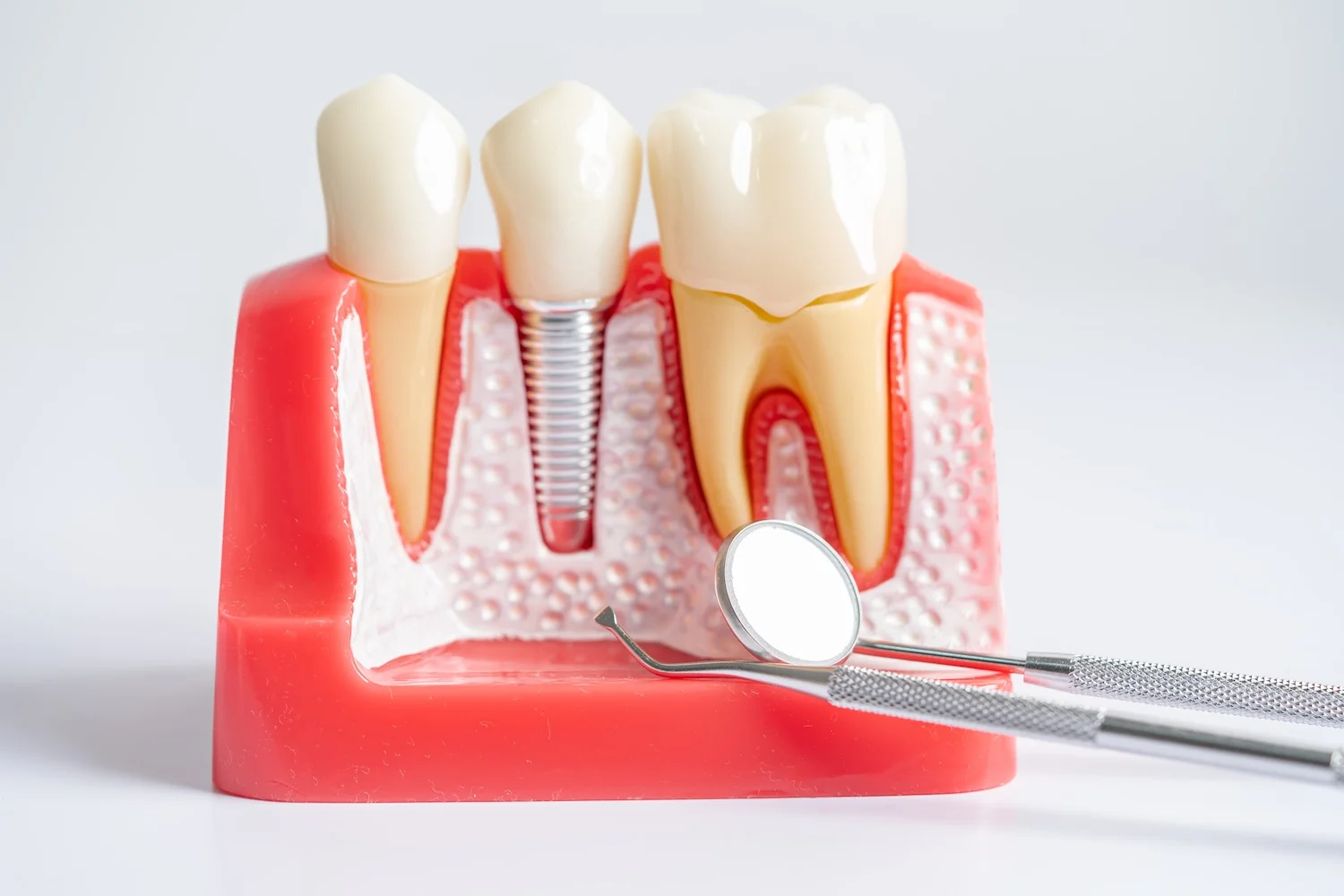Dental Model Cutout