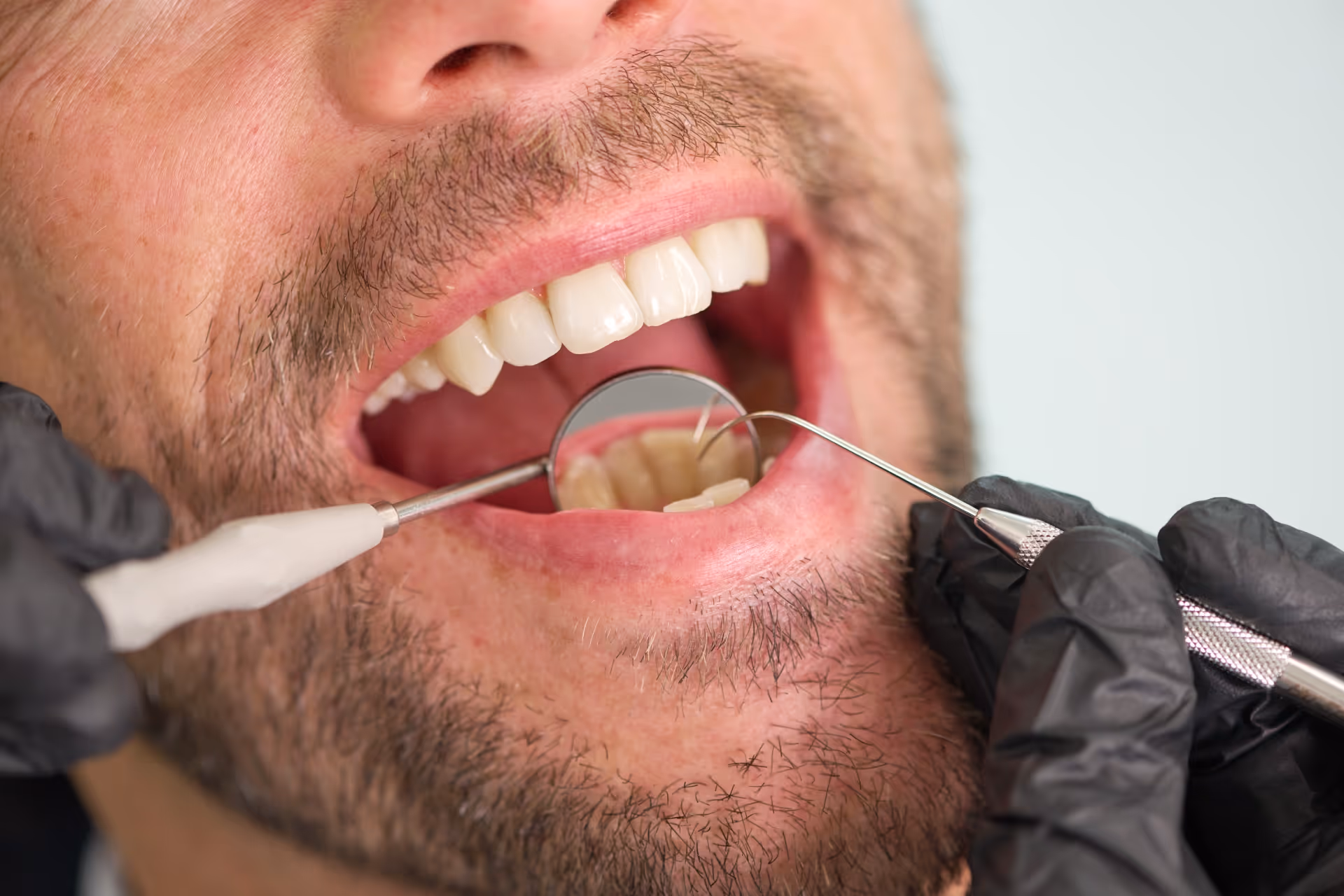 Typische Störfelder im Mundraum erkennen