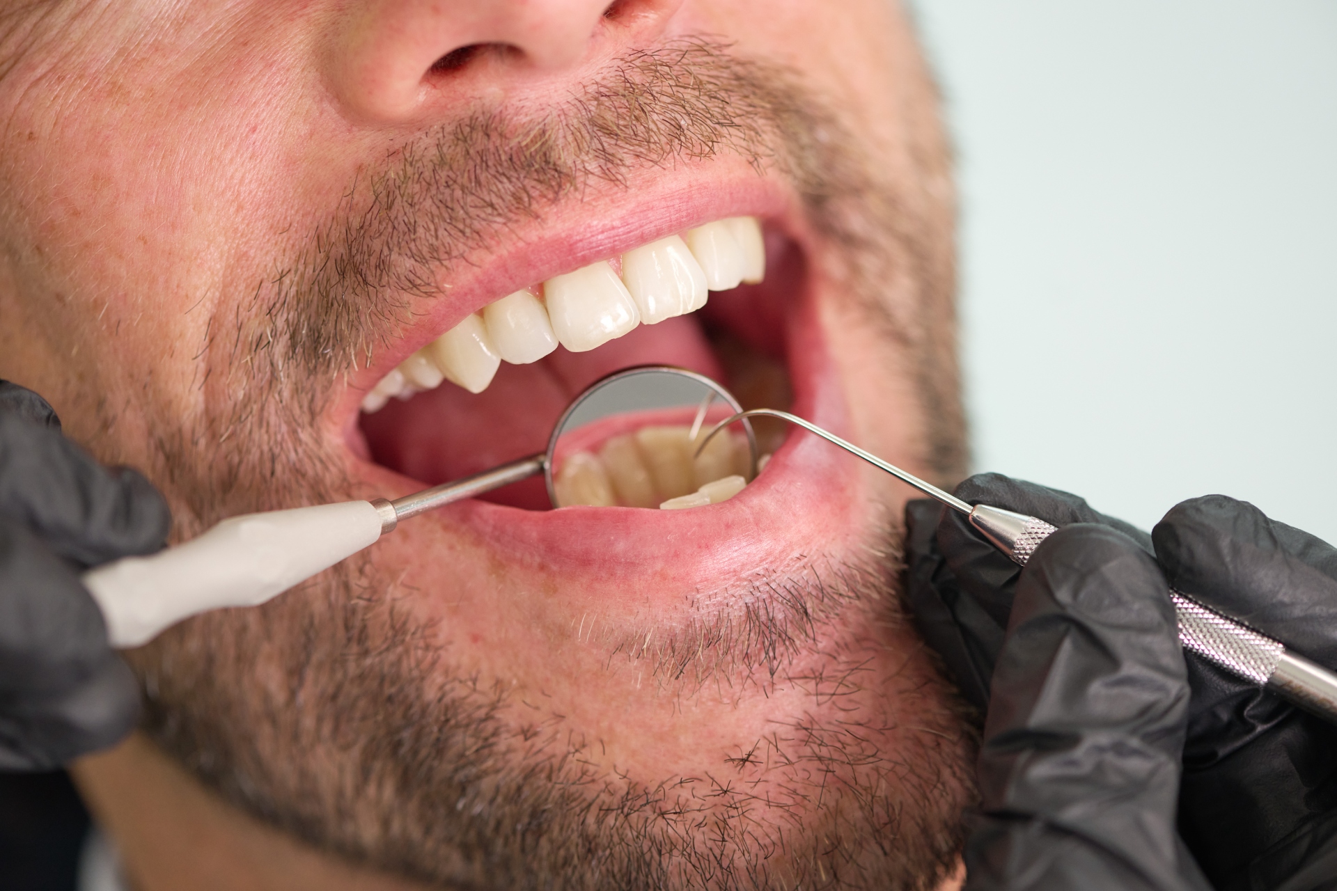 Zahnvorsorge bei dentprevent