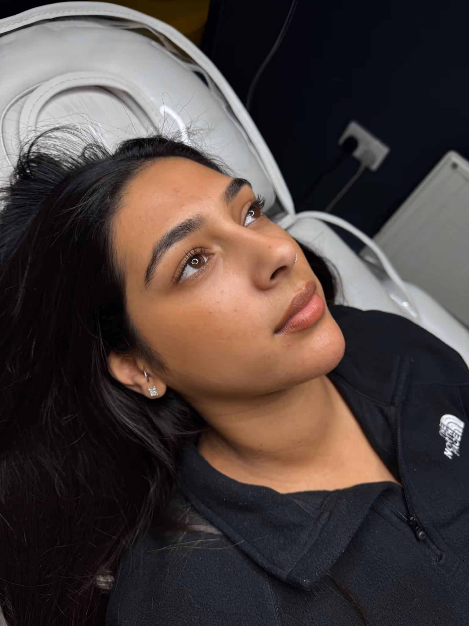 Before and after treatment results at CA Clinic Dubai