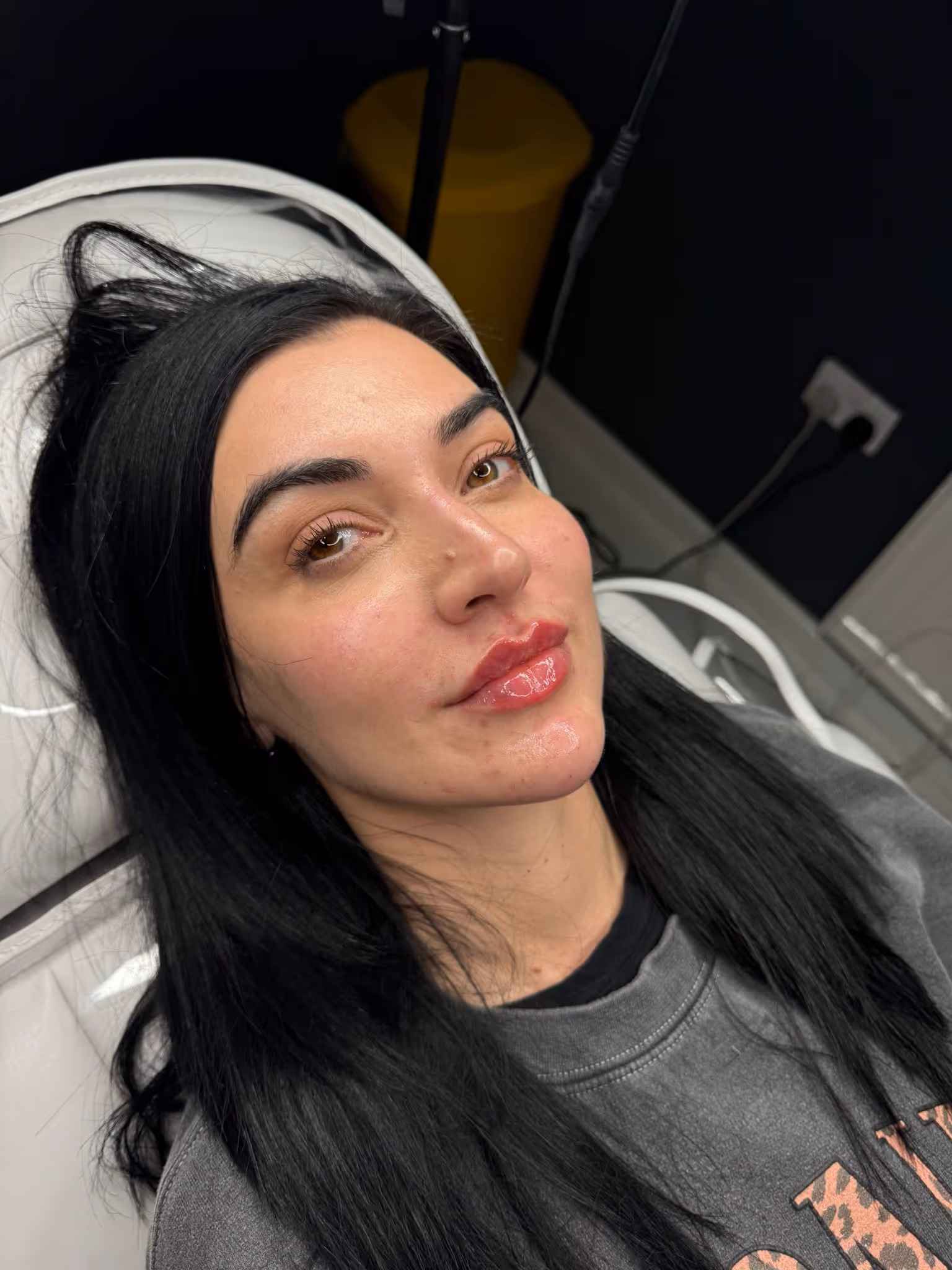 Treatment results at CA Clinic Dubai