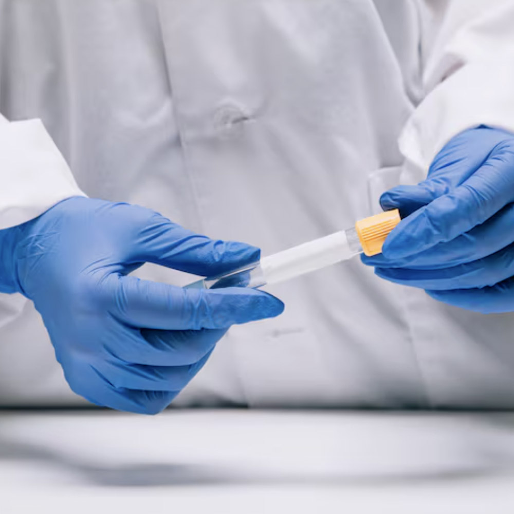 Laboratory professional wearing blue gloves handling a medical sample collection tube.