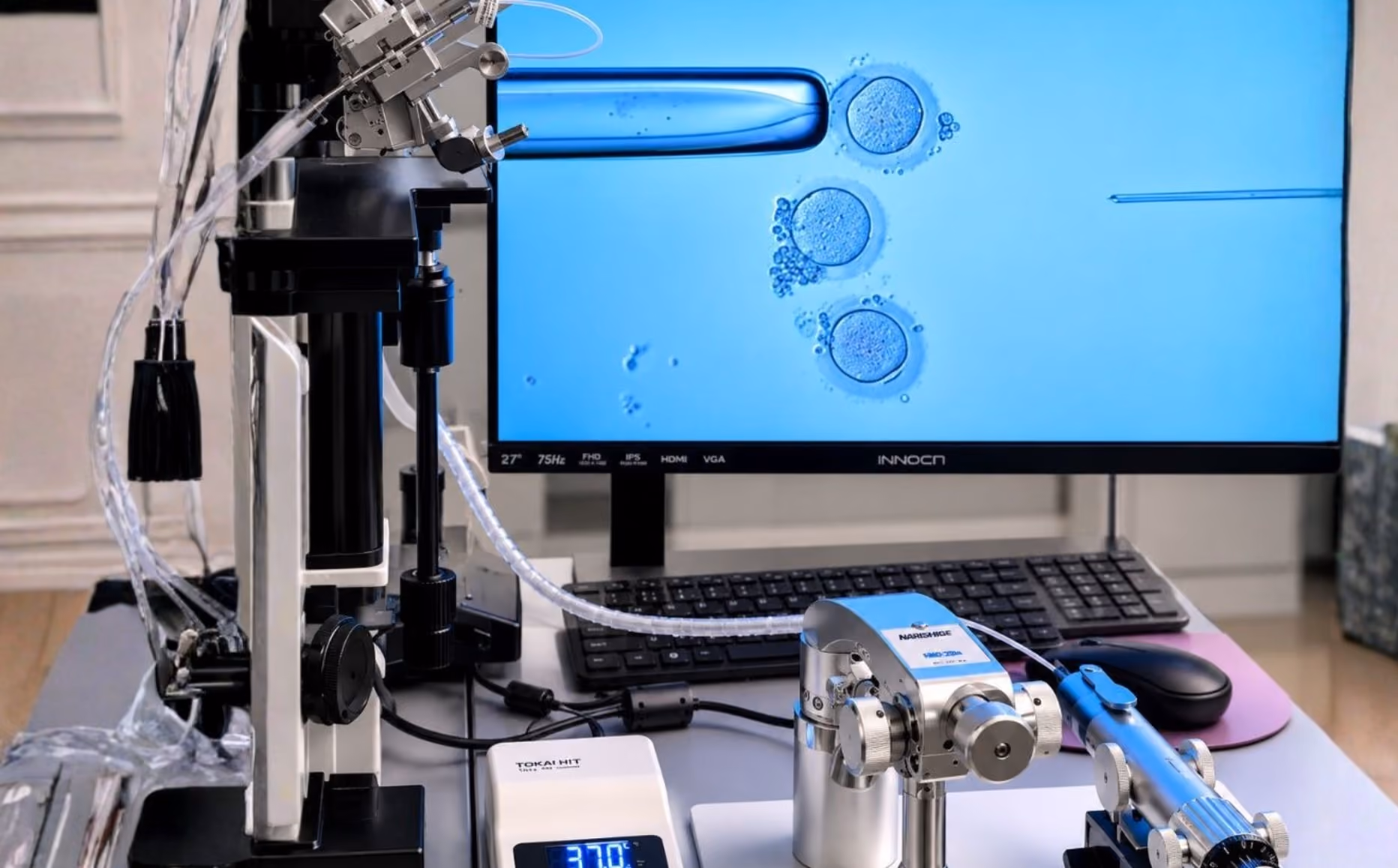 Micromanipulation system displaying egg cells on a monitor during an assisted fertilisation procedure in a fertility laboratory.