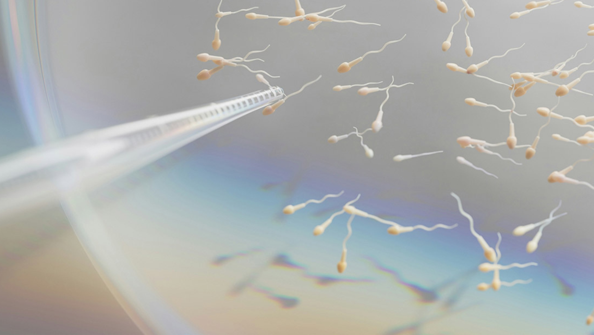 Illustration of sperm cells being examined and selected with a laboratory micropipette during fertility testing.