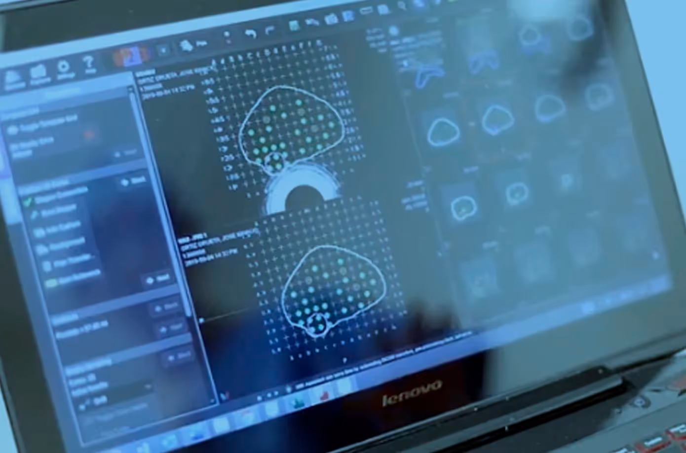 Precision Diagnosis with Focalyx® Dx