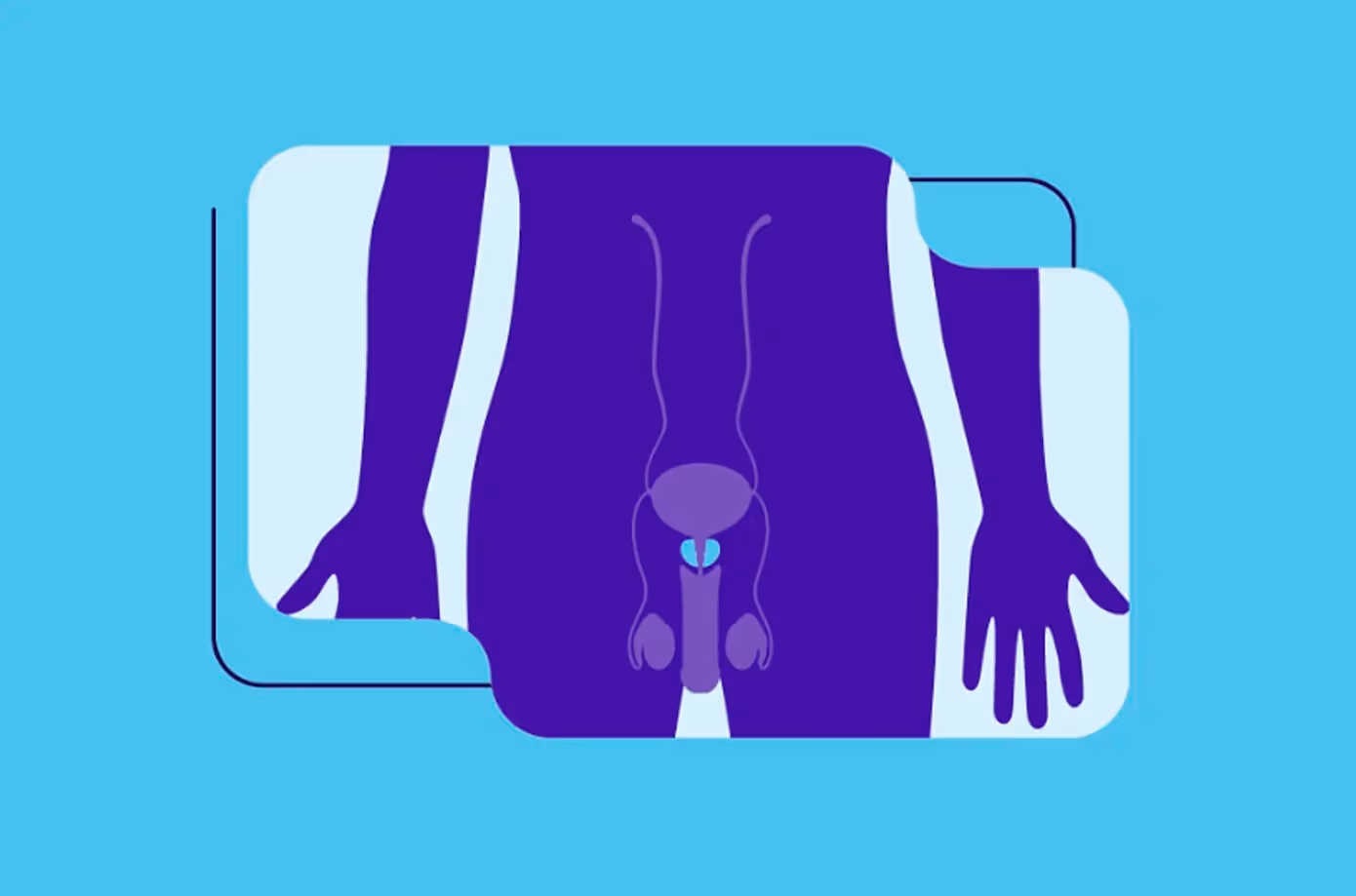 Focalyx® Fusion: the GPS against prostate cancer