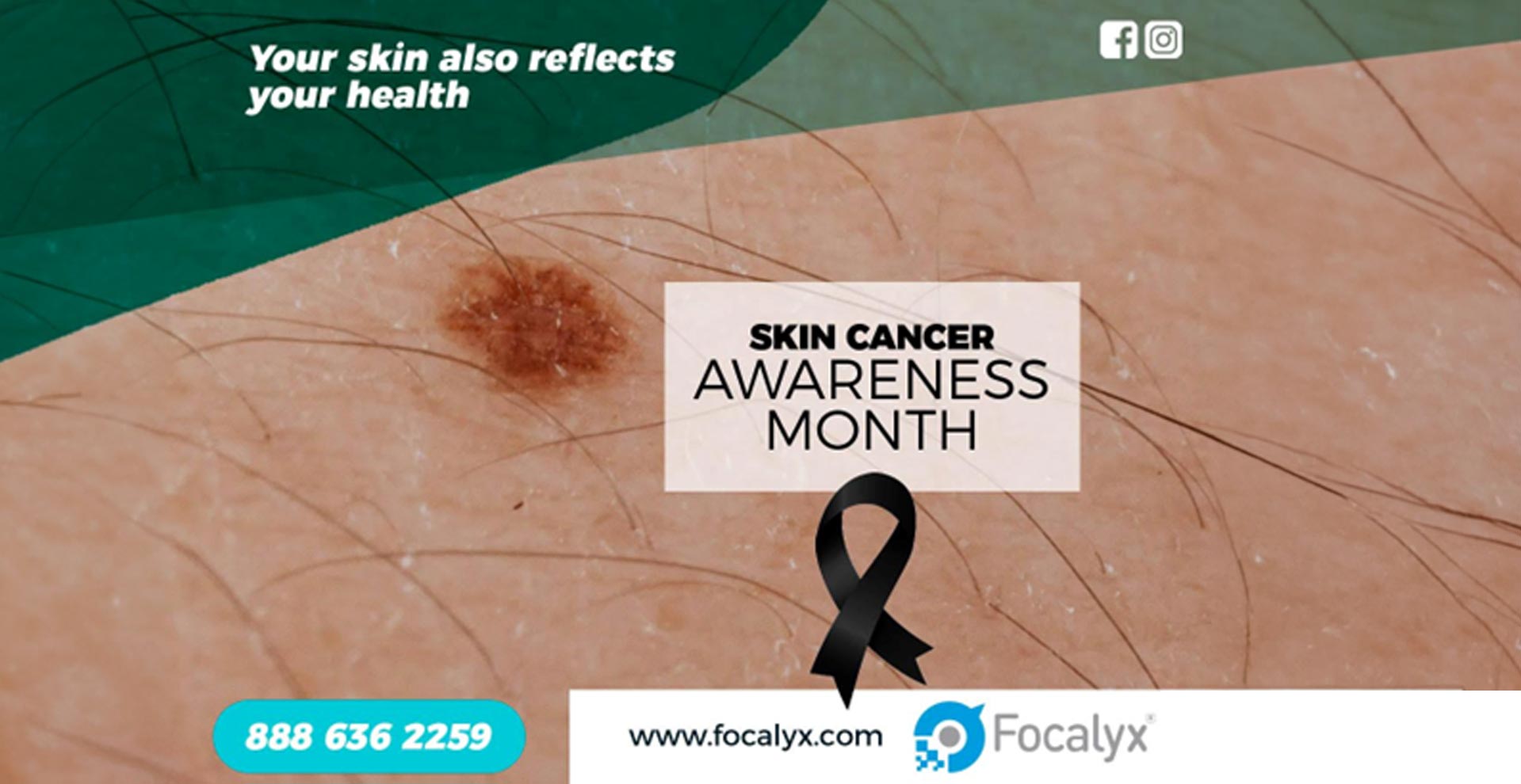 Skin Cancer Awareness: Embrace Holistic Health